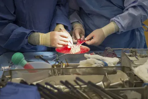 Surgeons work on a kidney during a transplant surgical procedure in Washington on June 28, 2016. (AP Photo/Molly Riley, File)