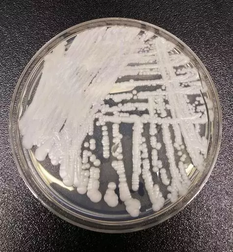 This undated photo made available by the Centers for Disease Control and Prevention shows a strain of Candida auris cultured in a petri dish at a CDC laboratory. In a CDC paper published by the Annals of Internal Medicine on Monday, March 20, 2023, U.S. cases of the dangerous fungus tripled over just three years, and more than half of states have now reported it. (Shawn Lockhart/Centers for Disease Control and Prevention via AP, File)