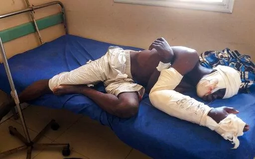 Saga Saganla, 30, from Diawely, lies on his bed at Somine Dolo hospital in Mopti, Mali, Friday June 24, 2022. Saganla survived an attack by nearly 100 jihadis on motorbikes who had gathered in his village in central Mali Sunday June 19. At least 132 people were killed in several villages in the Bankass area of central Mali during the attack on Saturday and Sunday, according to the government which blames the Group to Support Islam and Muslims jihadi rebels linked to al-Qaida.(AP Photo/ Hamidou S